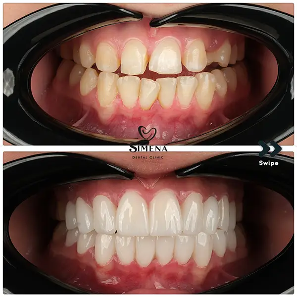 Dental Treatment Before & After