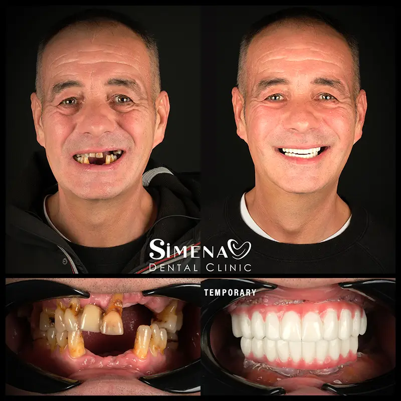 Dental Treatment Before & After