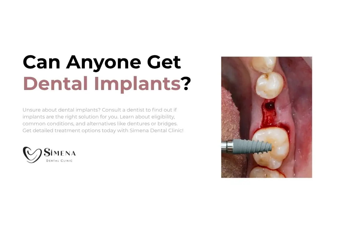 Can anyone get dental implants?