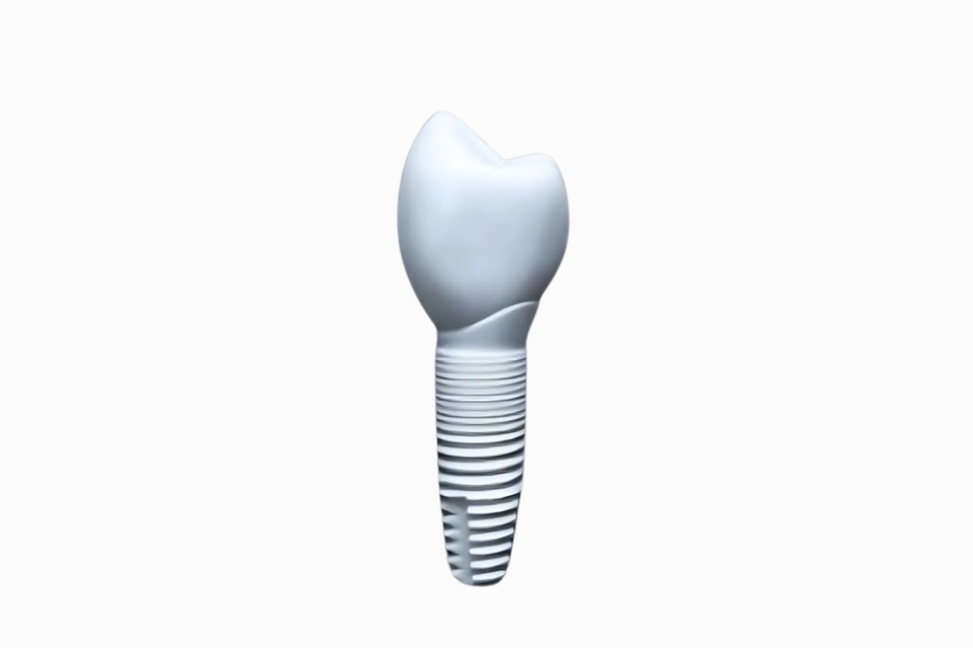Ceramic dental implant Ceramic dental implant in Antalya