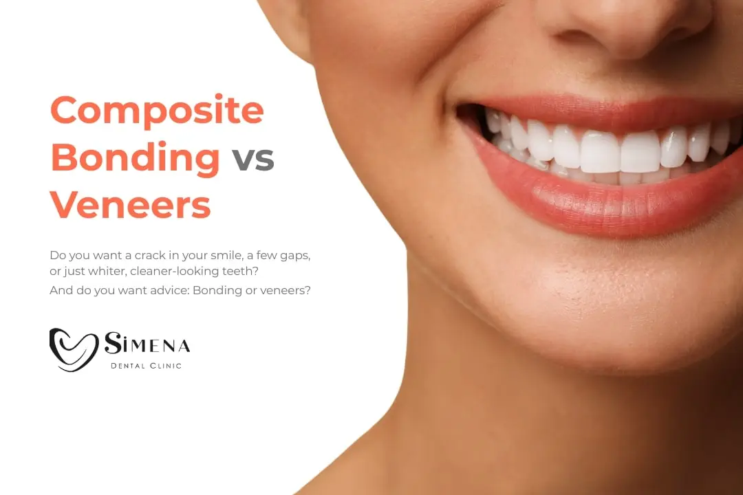 Composite Bonding vs Veneers: Which is right for me?