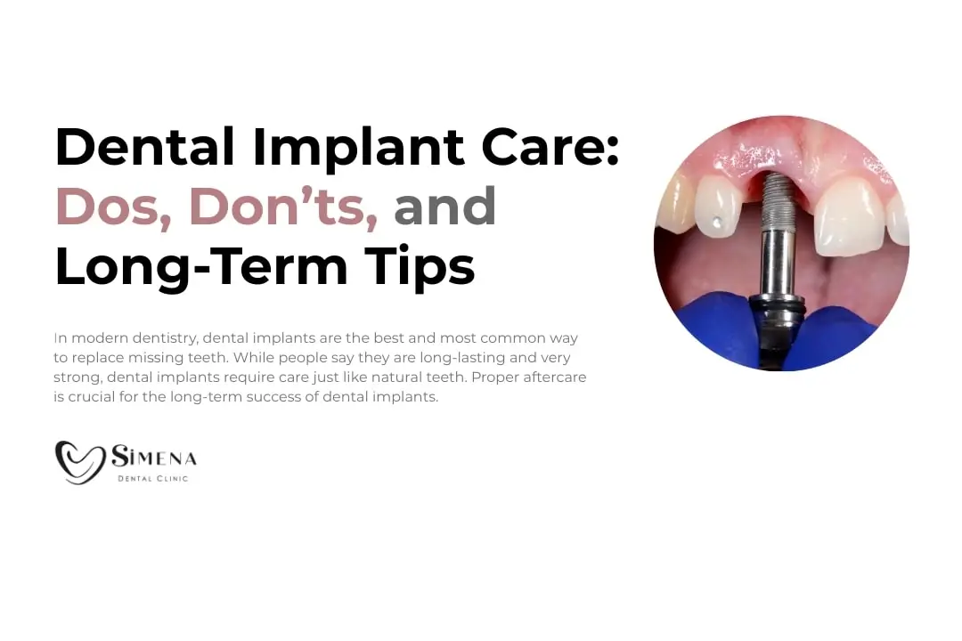 dental-implant-aftercare