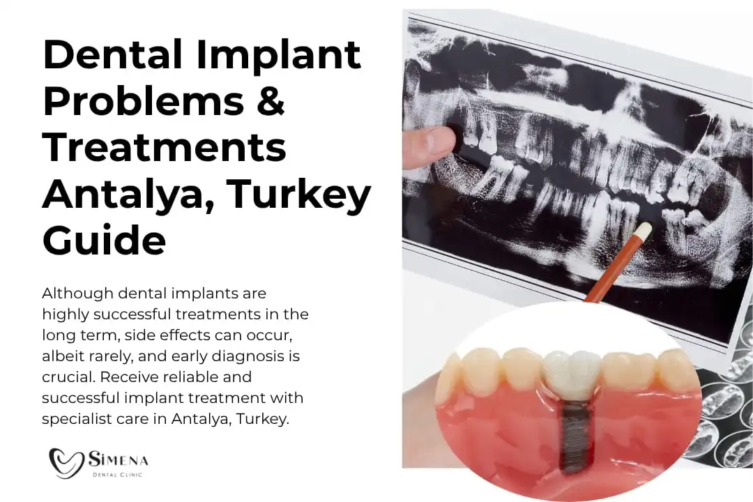 Dental Implant Problems & Treatments | Antalya, Turkey Guide