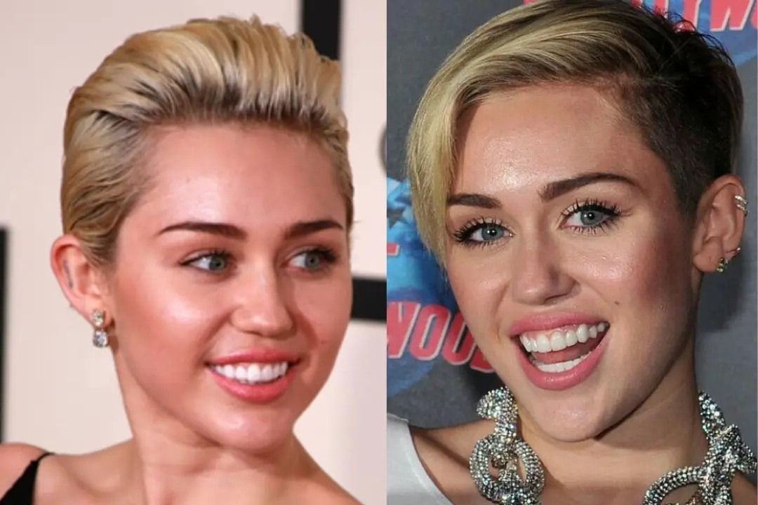 Miley Cyrus teeth in 2015 Miley Cyrus teeth in 2015