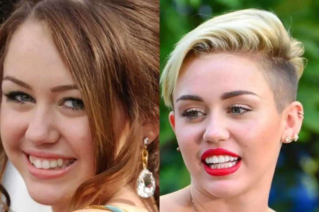 Miley Cyrus gum contouring Miley Cyrus gum contouring