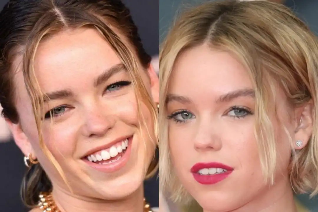 Milly Alcock's teeth: After transformation