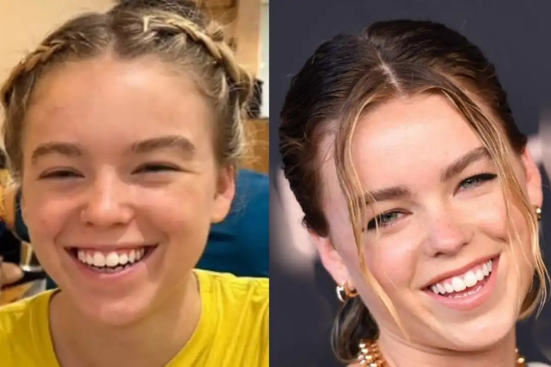 Milly Alcock's teeth