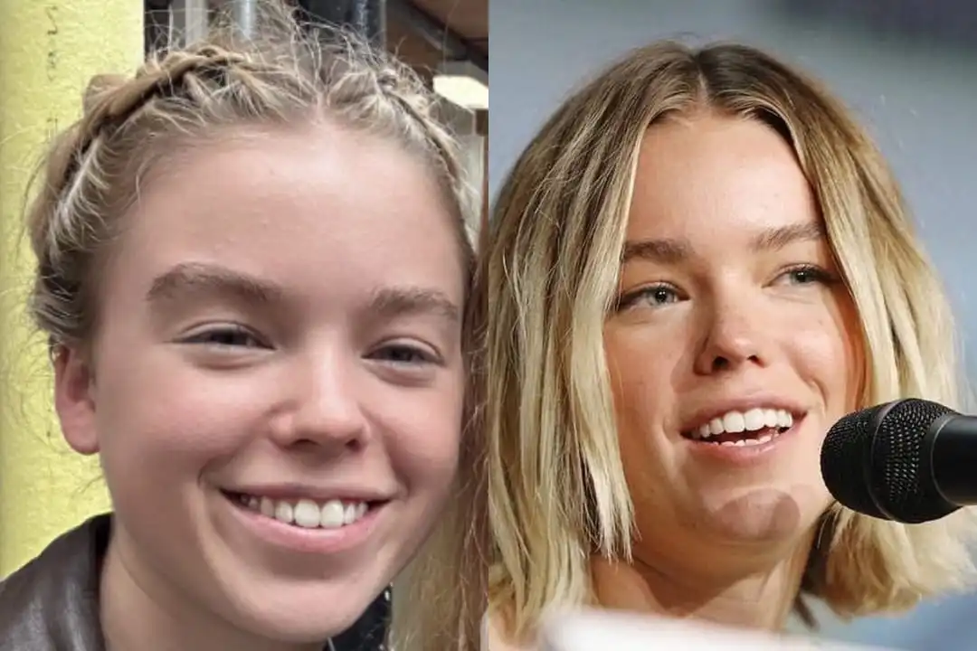 Milly Alcock's teeth before and after