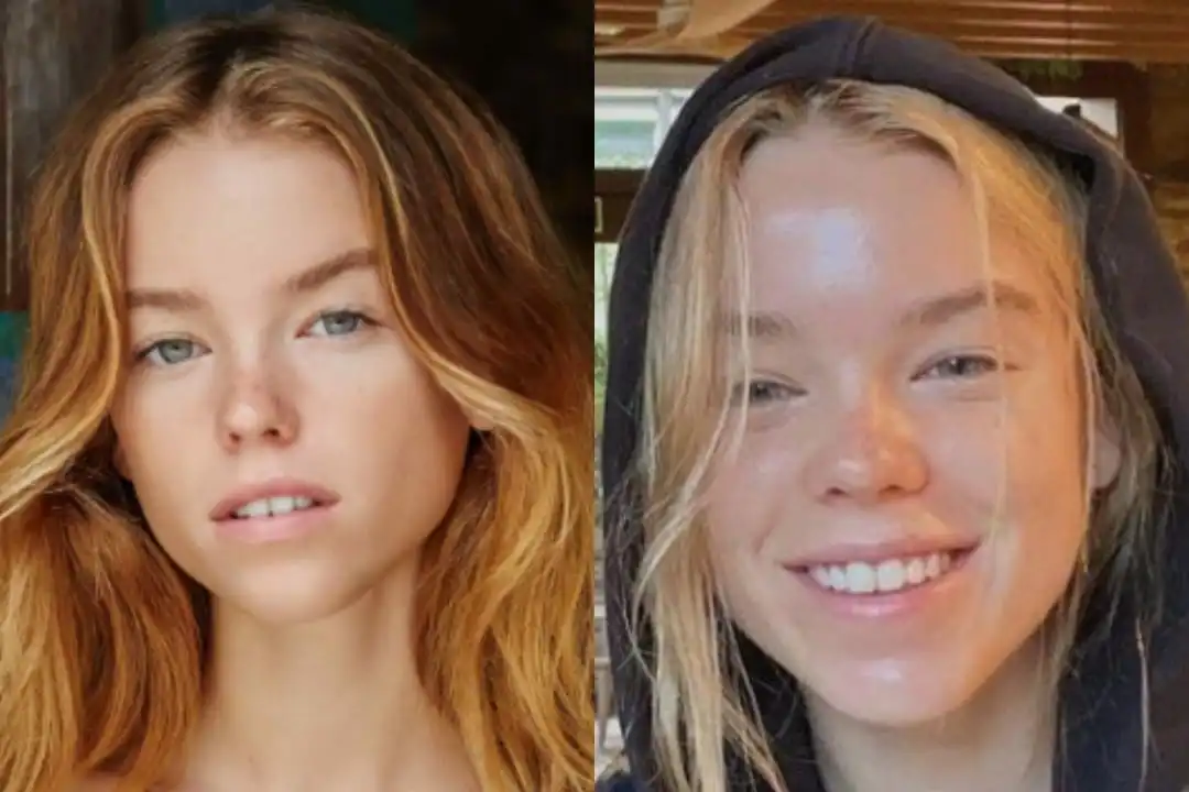 Milly Alcock's teeth: Before fame