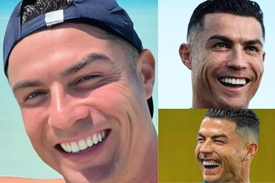 Cristiano Ronaldo teeth before after Cristiano Ronaldo teeth transformation