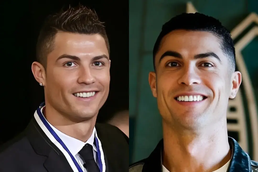 Cristiano Ronaldo teeth smile design Cristiano Ronaldo teeth smile design