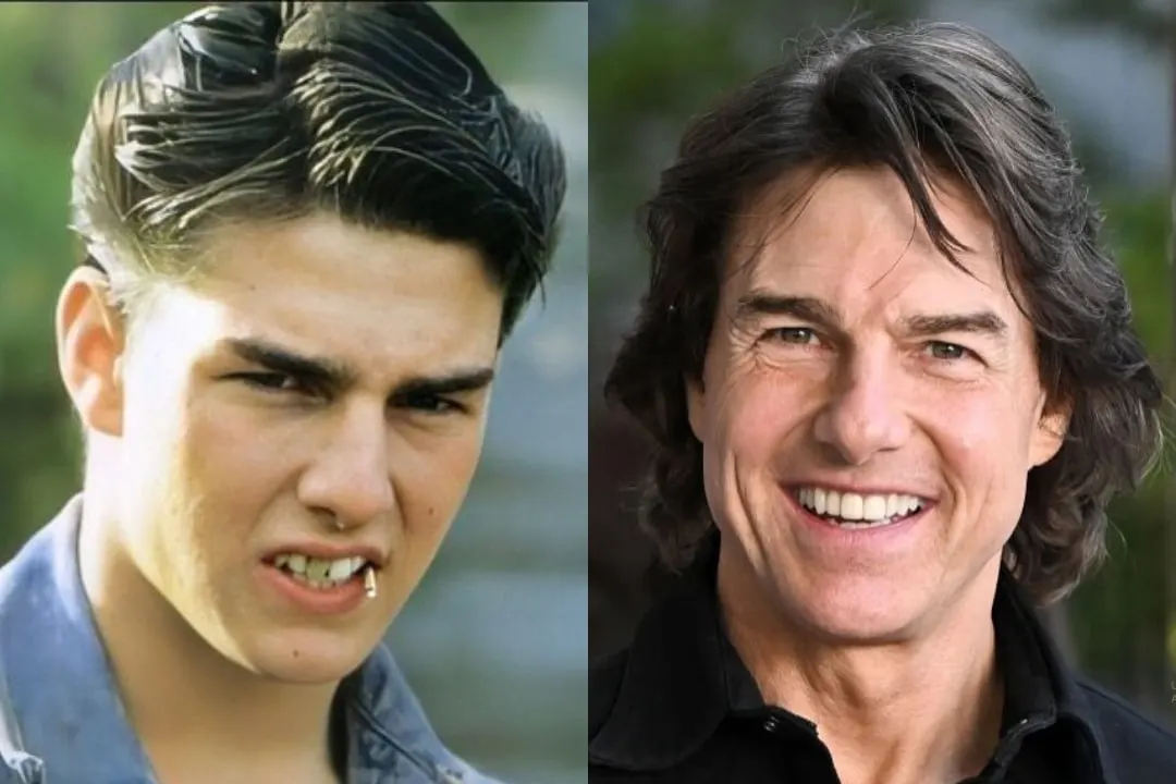 Tom Cruise teeth before after Tom Cruise teeth