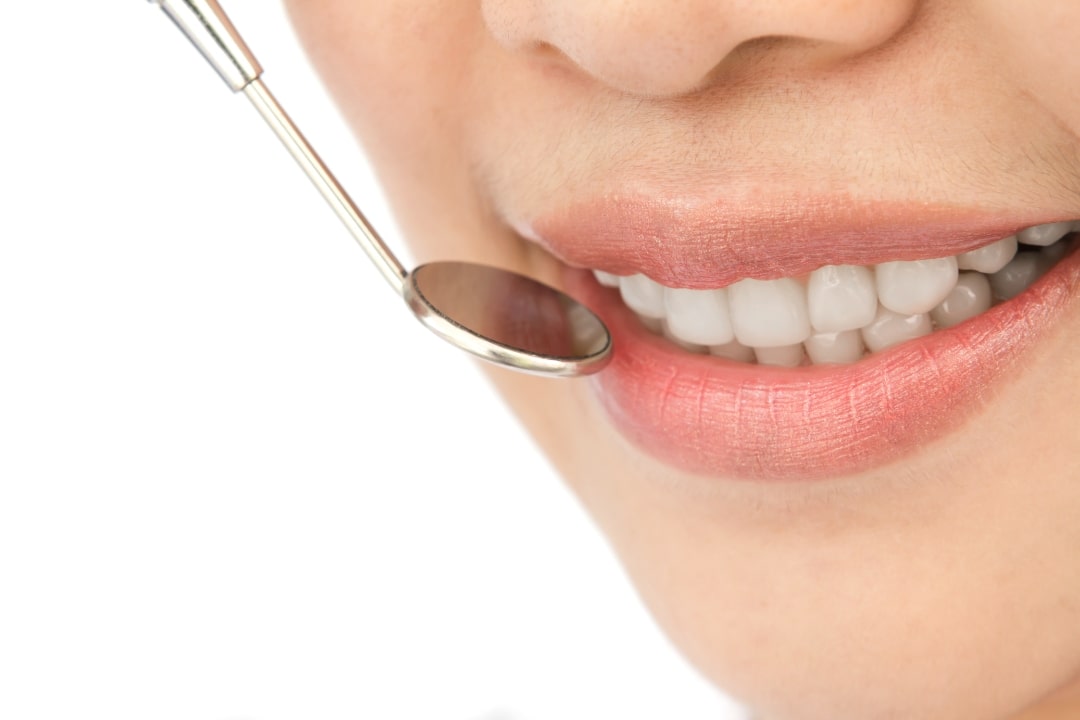 What are Turkey teeth? What are Turkey teeth?