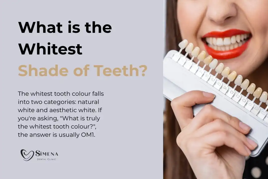 What is the whitest shade of teeth? What is the whitest shade of teeth?