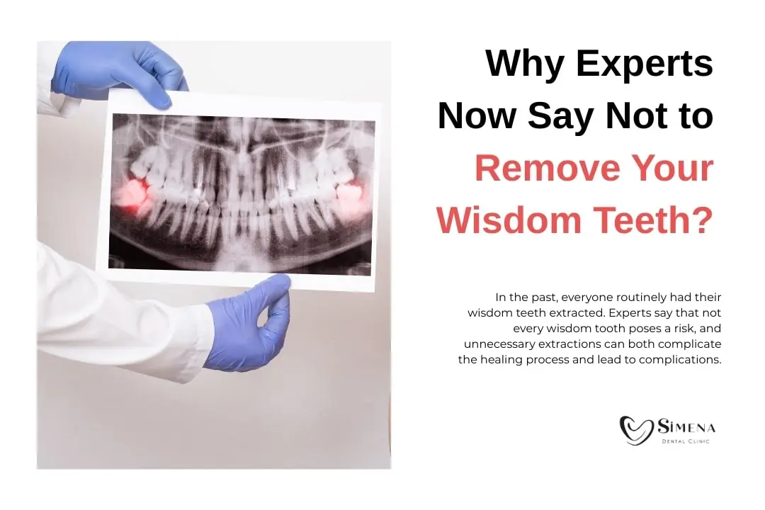 Why Experts Now Say Not to Remove Your Wisdom Teeth? Why Experts Now Say Not to Remove Your Wisdom Teeth?
