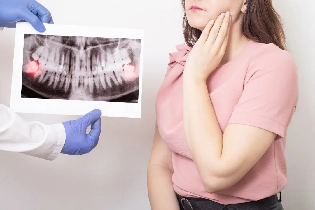 Why some experts now say not to remove your wisdom teeth?